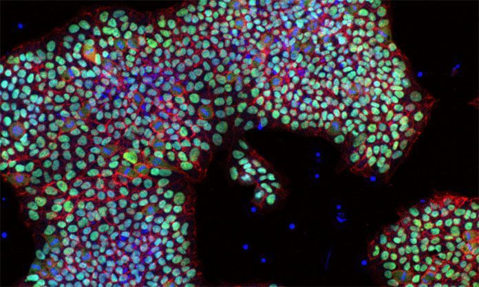 Human embryonic stem cell line HUES1 grown in the new conditions E8+Inter-alpha-inhibitor and imaged for stem cell marker Oct4 (green) and cell-cell attachment molecule E-cadherin (red) with nuclear counter-staining (blue). Credit: Dr. Sara Pijuan-Galito and Dr. Cathy Merry, Wolfson Centre for Stem Cells, Tissue Engineering & Modelling and Centre for Biomolecular Sciences, The University of Nottingham