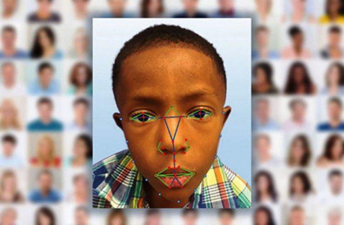 Researchers Use Facial Recognition Software to Diagnose a Rare, Genetic Disease