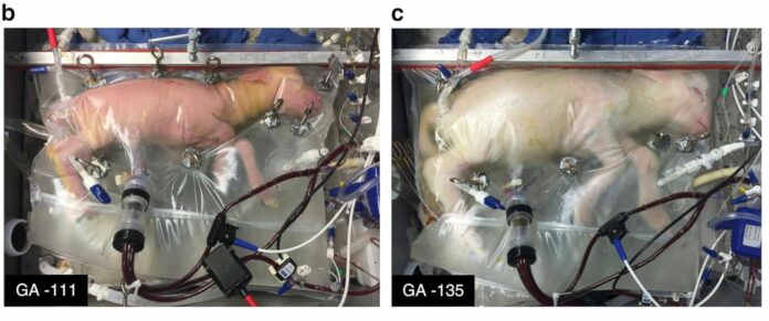 This Artificial Womb Just Successfully Grew a Sheep, Humans Could Be Next