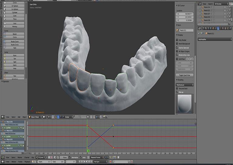 College Student 3D Prints Cheap DIY Retainers to Fix His Crooked Teeth