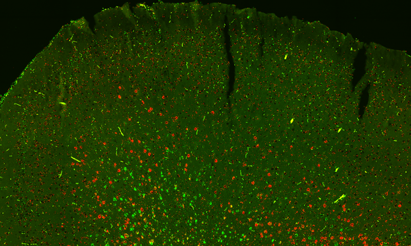 Scientists Discovered New Kind of Brain Cells