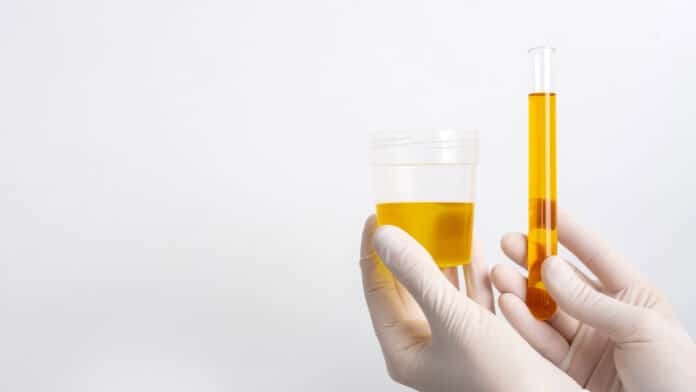 Image showing urine sample