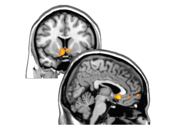 Self-Esteem Mapped in the Human Brain