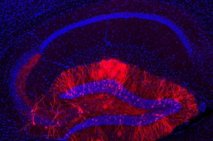 MIT Neuroscientists Build Case for New Theory of Memory Formation