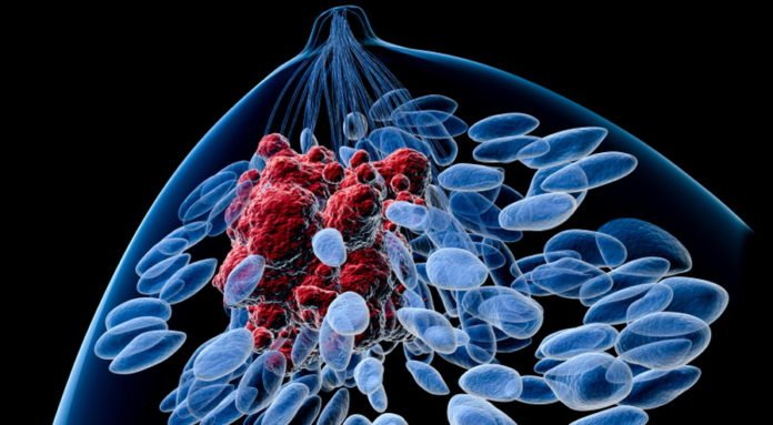 Researchers find a potential new treatment for advanced cancer