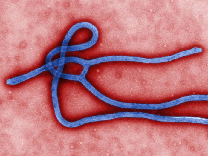New technology for diagnosing immunity to Ebola virus infection