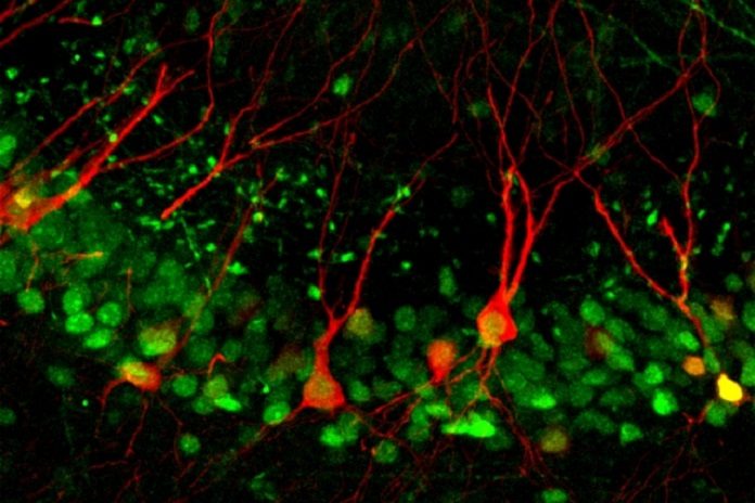 neurons in the CA3 region of the hippocampus