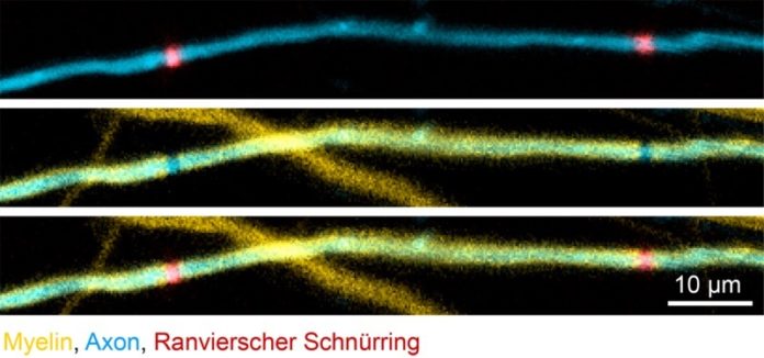 Using newly developed markers, the scientists were able to visualize axons, myelin, and nodes of Ranvier in vivo