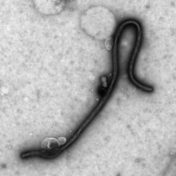 Deadly ebola virus exploits host enzyme for efficient entry to target cells