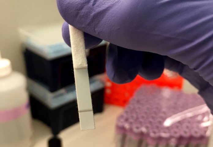 Prompt HIV detection method could diagnose premature disease