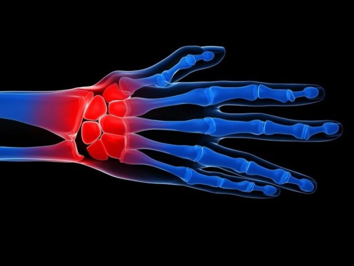 Looming dearth of rheumatologists is major concern of researchers