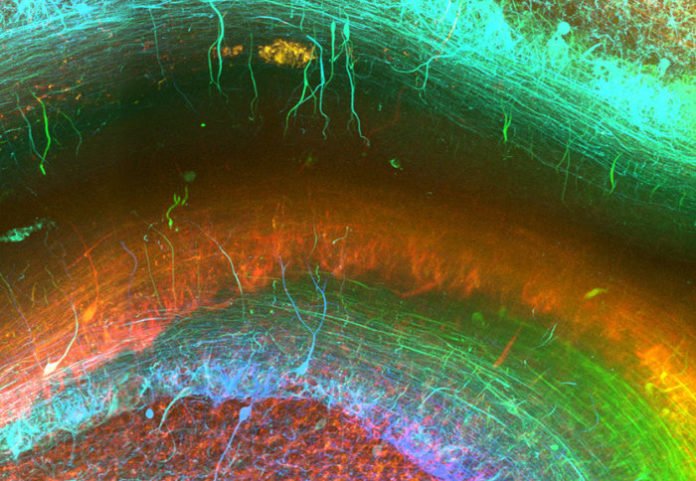 Imaging method enables researchers to generate stunning 3D images of human brain tissue