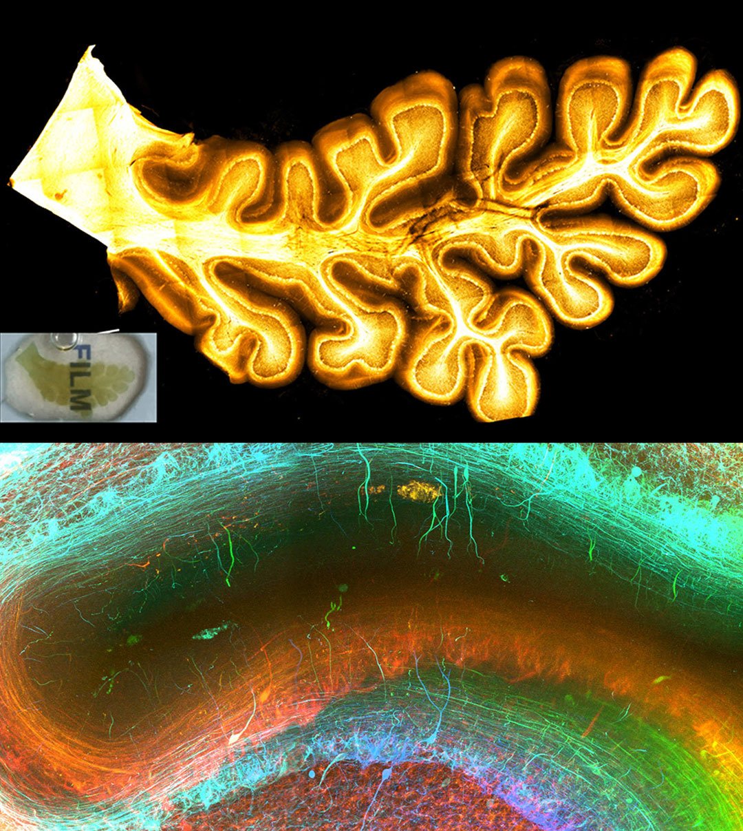 Technique reveals microscopic brain structures. Top: A small cross section of the cerebellum; Bottom: The close up of a fragment of the same sample, revealing networks of brain cells
