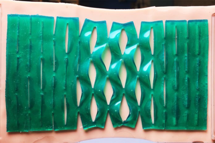 Ruike Zhao, a postdoc in MIT’s Department of Mechanical Engineering, says kirigami-patterned adhesives may enable a whole swath of products, from everyday medical bandages to wearable and soft electronics. Image courtesy of researchers