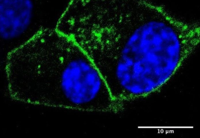 A cell with drug receptors on its surface (green)