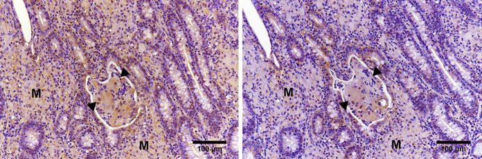 Immunohistochemical analysis showing expression of PGE2 (left) and PD-L1 (right) in the ileal mucosa of a cow with Johne’s disease.