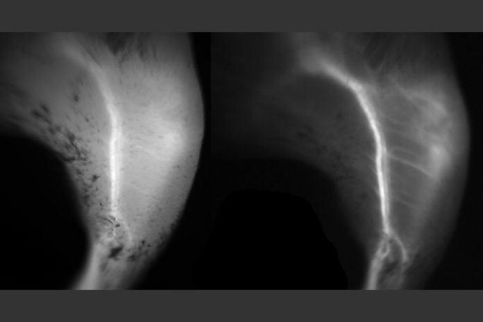 A comparison of blood vessels imaged with short-wave fluorescence imaging (right) and near-infrared fluorescence imaging (left). Both images rely on a fluorescent dye called ICG, but the vessels can be seen more clearly with short-wave fluorescence imaging.