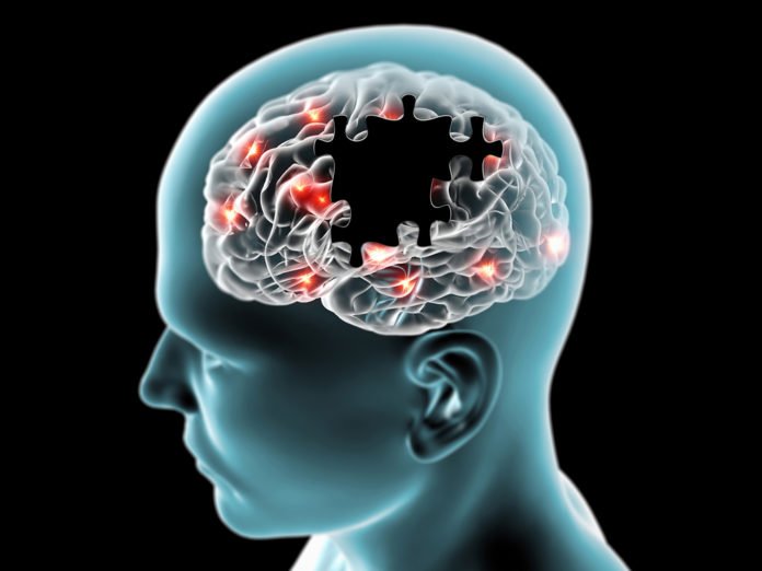 Brain degenerative diseases Parkinson, Alzheimer, puzzle