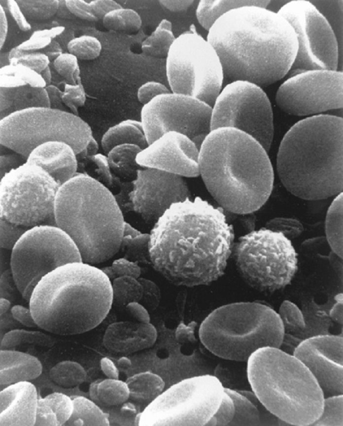 Human blood cells under the scanning electron microscope. Credit: National Cancer Institute