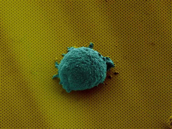 In the cover image of a forthcoming issue of Small, a single lymphoma cell is isolated on the new biosensor (magnified 2,700 times). Photo: EPFL