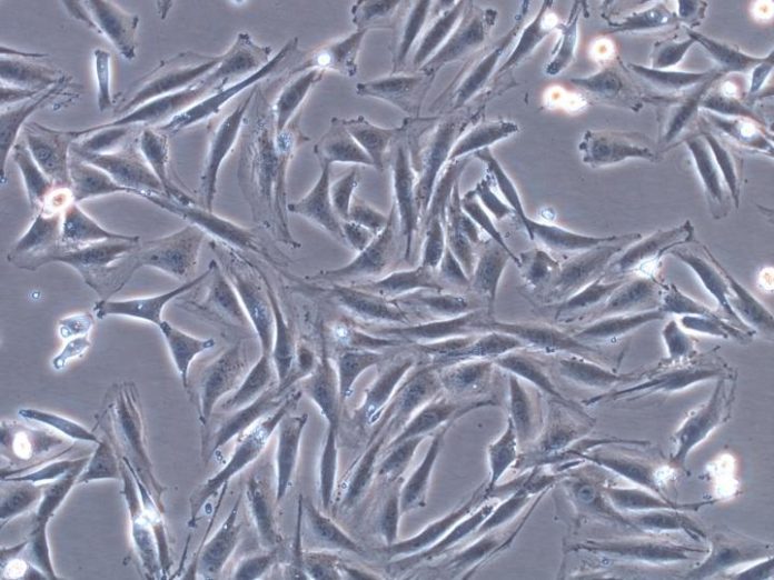 CAPTION These are skeletal myoblast cells in rats. CREDIT Yuge Lab