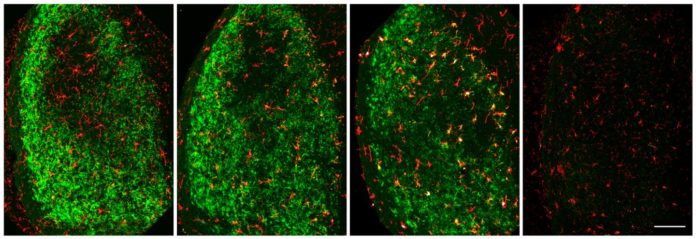 Microglia (red) gradually clear away the neuronal debris (green) produced following damage to the optic nerve. CREDIT Norris et al., 2018