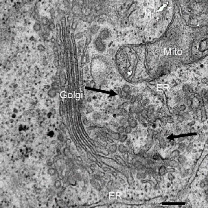 Image of a cell's interior without USP8 Electron microscopy imaging reveals the presence of many interconnected vesicles, which appear to behave like collagen carriers (indicated by arrows).