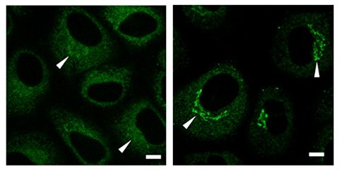 Images of cells with USP8 (left panel) and without USP8 (right panel) Immunostaining experiments revealed a high concentration of collagen (green signals) in the Golgi region prior to secretion.