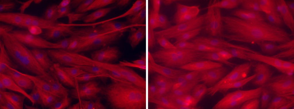 The cultured cells lacking gcn5l1(right) formed thicker muscle fibers comparing to normal cells (left). (Fukushima A. et al., The Journal of Clinical Investigation Insight, May 17, 2018)