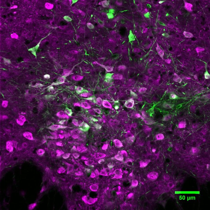 Microphotography of serotonin-producing neurons (in pink) in the mouse brain. CREDIT Matias, Lottem et al./CCU