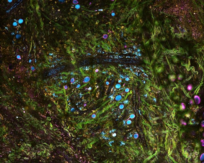 Illinois researchers developed a tissue-imaging microscope that can image living tissue in real time and molecular detail, allowing them to monitor tumors and their environments as cancer progresses. Image courtesy of Stephen Boppart