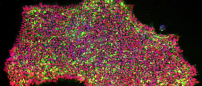 CRISPRa reprogrammed induced pluripotent stem cell colonies stained for pluripotency marker expression.