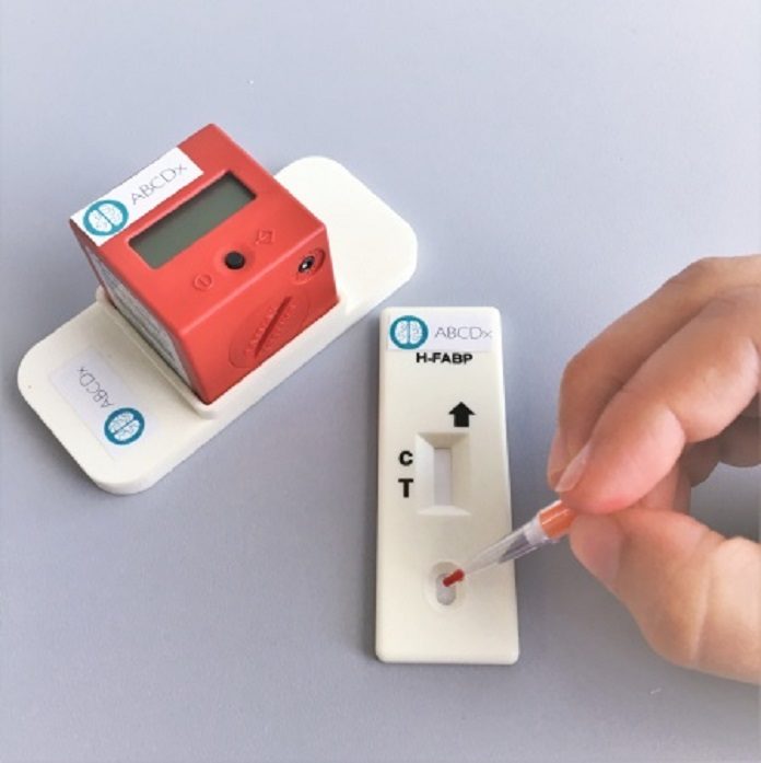 One drop of blood is enough for TBIcheck to diagnose a possible mild brain trauma. If a line appears below the control line, the injured person will have to go to the hospital for a CT scan. © UNIGE