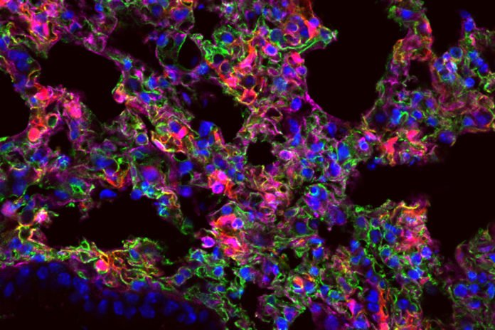 MIT researchers have designed nanoparticles that can deliver messenger RNA to specific organs. In this image, lung cells expressing the synthetic mRNA show up as red. Image: Piotr Kowalski