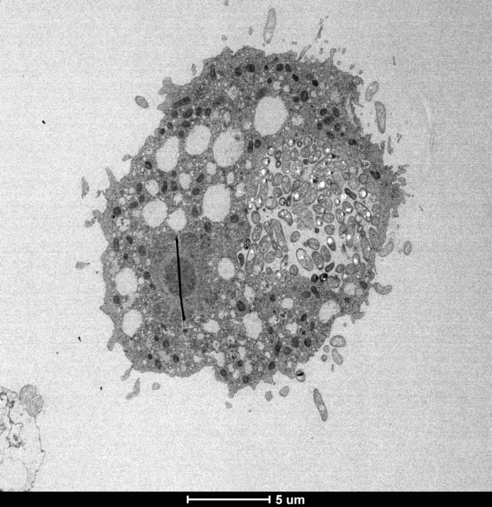 Electron micrograph of the cholera-causing pathogen inside an aquatic amoeba