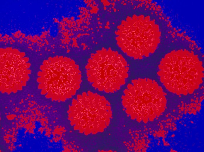 A cluster of rotaviruses. The image is from a transmission electron micrograph and has been colored