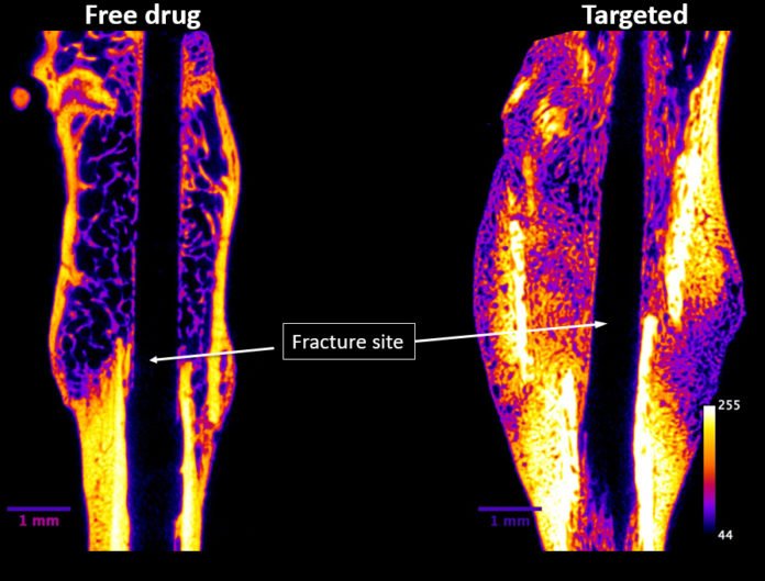 Novosteo, a Purdue-affiliated startup, is advancing a technology shown to repair bone fractures faster and at greater benefit to a patient. The image above shows fractured femurs at four weeks post-fracture. The ‘Targeted’ bone received Novosteo’s injectable-targeted drug. Yellow and orange colors indicate higher density bone than purple and blue. (Image provided by Novosteo)