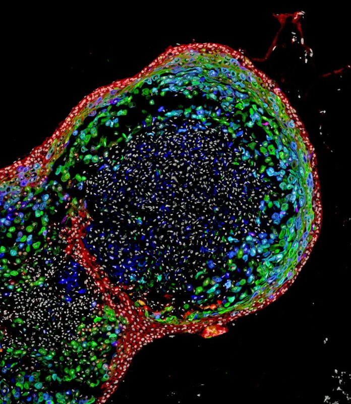 This confocal microscopic image shows a two-month-old human esophageal organoid bioengineered by scientists from pluripotent stem cells. About 700 micrometers (0.027 inches) in size, the organoid is stained to visualize key structural proteins expressed in mature esophagus, such as involucrin (green) and cornulin (blue). Researchers report in the journal Cell Stem Cell the organoids enhance the study of esophageal disorders, personalized medical and the development of regenerative tissue therapies for people. CREDIT Cincinnati Children's
