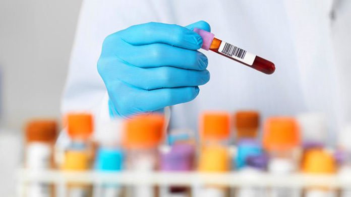 Blood test - Alamy