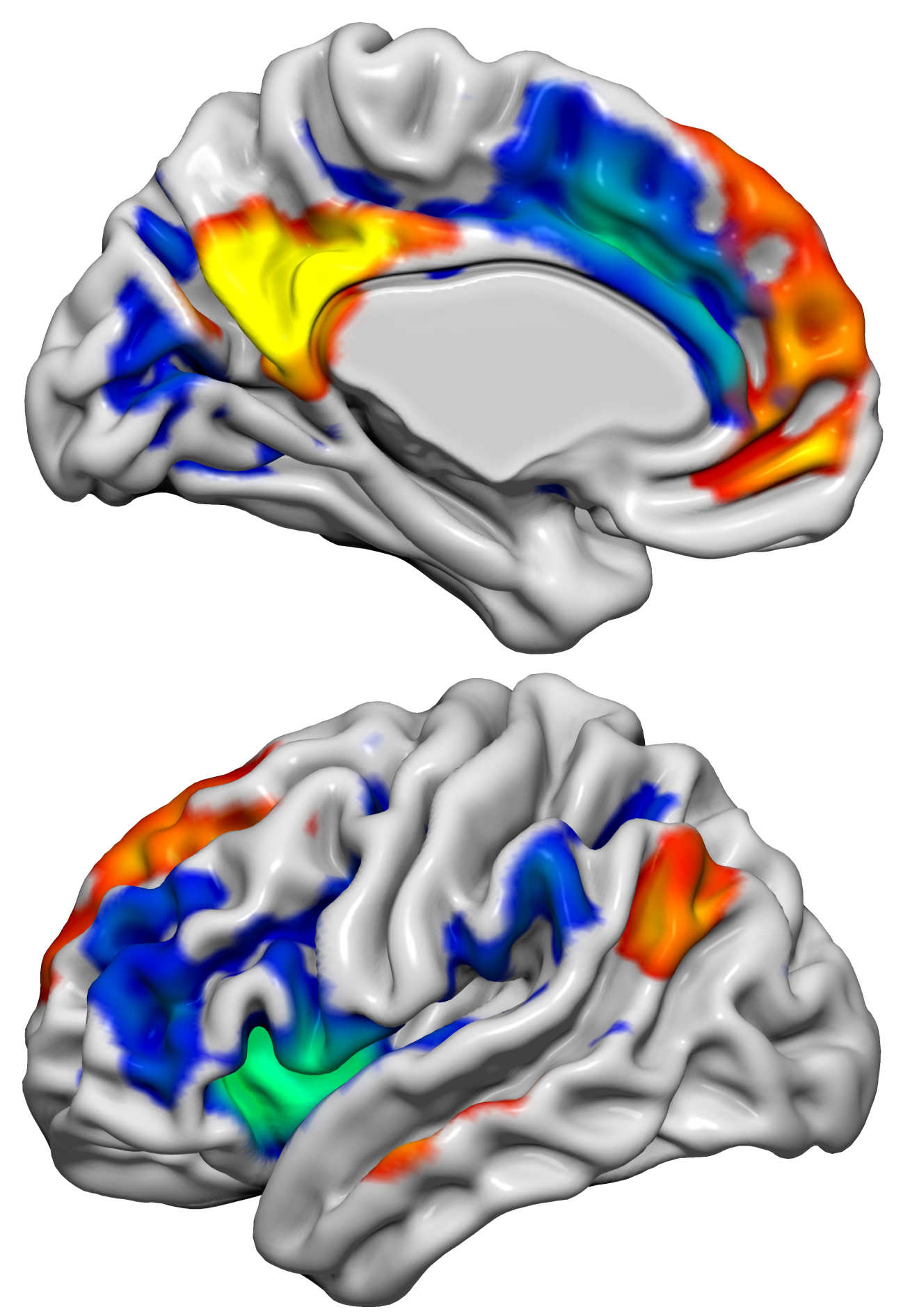 This image shows the Default Mode Network (red/yellow) and the Salience Network (blue/green) which have important roles in social and emotional function. These two networks in the brain were altered when the volunteers received the hormone kisspeptin, and this was associated with changes in brain activity linked to sexual aversion and sexual arousal.