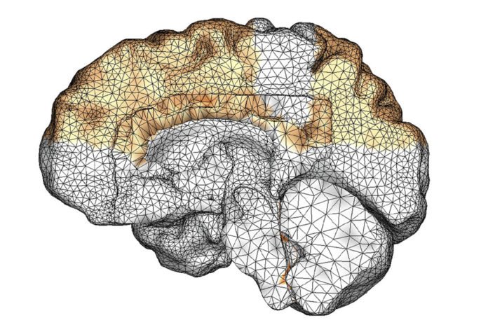 A Stanford-led team has created a new computer model that shows how amyloid beta proteins spread though the brain in dementia cases. (Image credit: Courtesy Living Matter Lab, Stanford University)