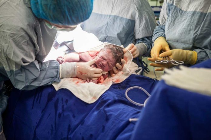 The global rate of C-section doubled from 2000 to 2015 and now accounts for more than 1 in 5 live births.