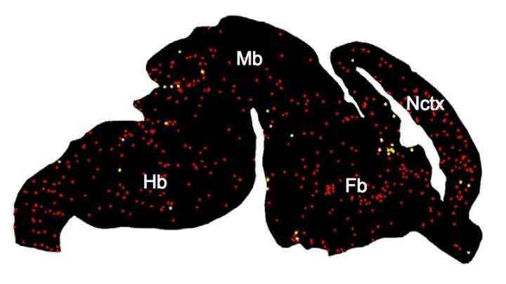 This prenatal mouse brain shows the distribution of microglia (from left to right, the hindbrain, midbrain, forebrain and neocortex). The yellow microglia bear markers indicating that they belong to unique populations not detected in the past. Credit: Timothy Hammond / Boston Children's Hospital