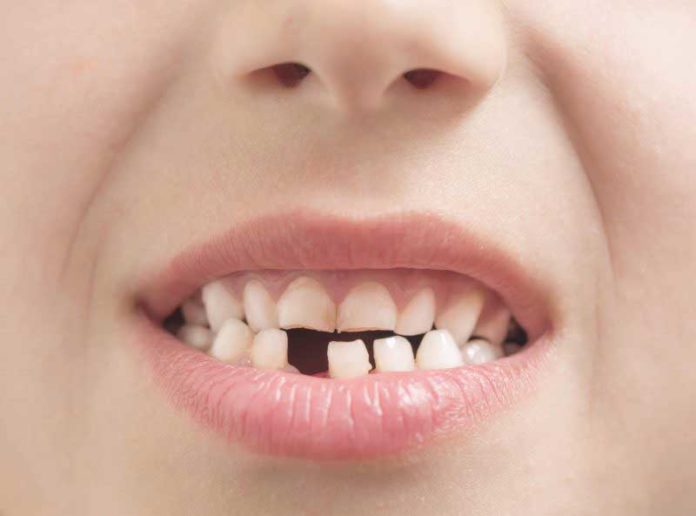 Tooth loss may lead to high BP in older women