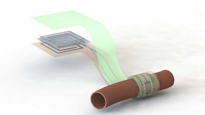 Artist’s depiction of the biodegradable pressure sensor wrapped around a blood vessel with the antenna off to the side (layers separated to show details of the antenna’s structure). (Image credit: Levent Beker)