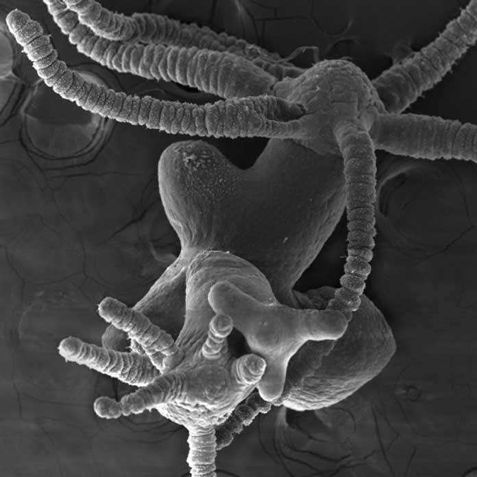 A Hydra that produces too little Sp5 spontaneously develops multiple heads. © Brigitte Galliot, UNIGE