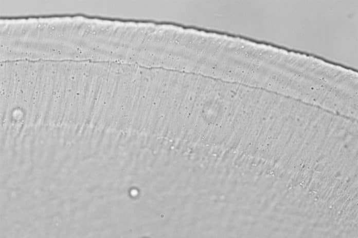 This image, taken through an optical microscope, shows a cross-section of the tectorial membrane, a gelatinous structure that lies atop the tiny hairs that line the inner ear. Photo by Jonathan Sellon, MIT micromechanics group
