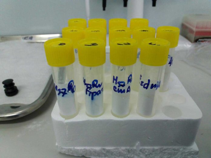 This is a holder with samples of mycobacterial strains with different antibiotic resistance. CREDIT Andrey Zyubin