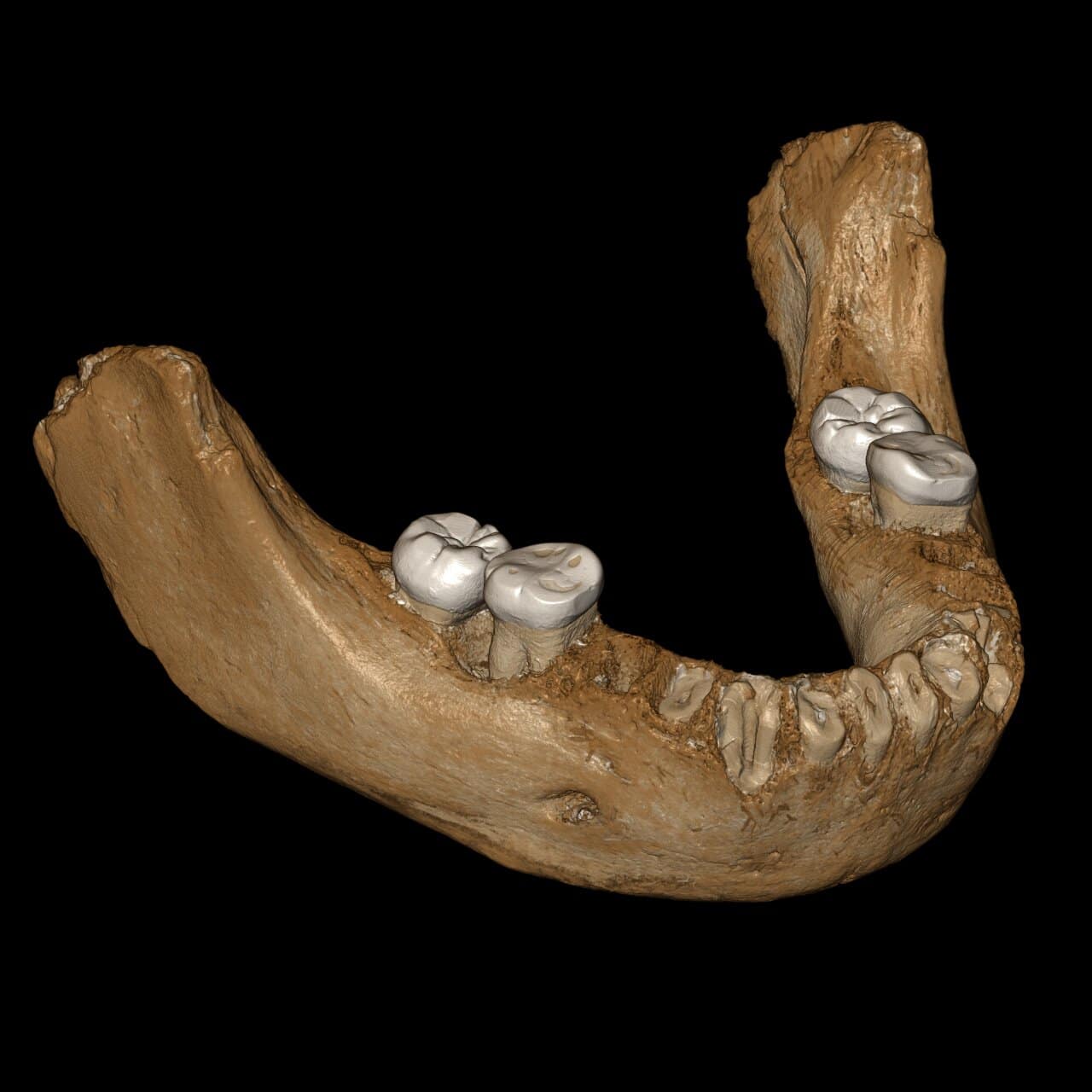 Views of the virtual reconstruction of the Xiahe mandible after digital removal of the adhering carbonate crust. The mandible is so well preserved that it allows for a virtual reconstruction of the two sides of the mandible. Mirrored parts are in grey. Credit: Jean-Jacques Hublin, MPI-EVA, Leipzig
