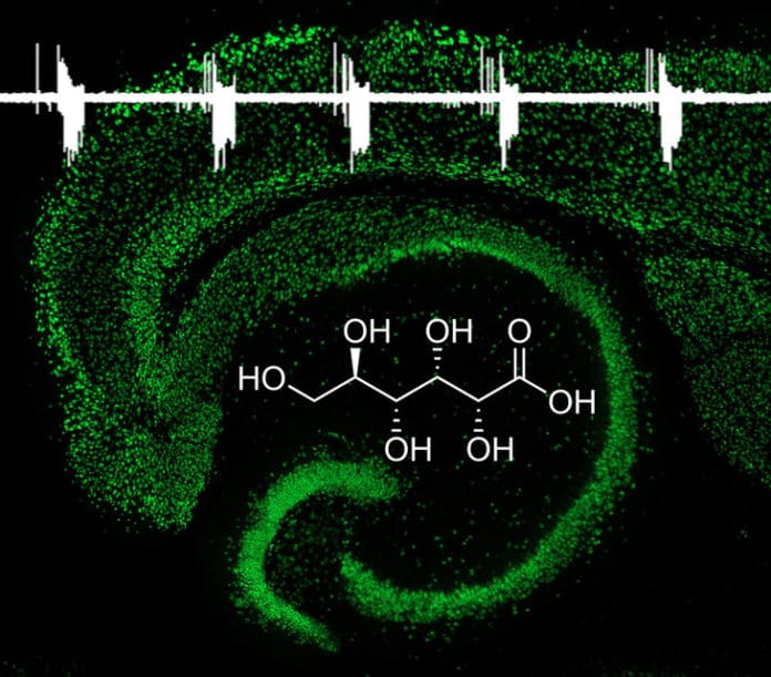 Gluconate, a small organic molecule, inhibits neonatal seizures in rodent models and could open up new avenues for the treatment of epilepsy in human newborns. The image illustrates the structure of neonatal hippocampus (green), overlaid with a typical electrophysiological trace of seizure activity, and the molecular structure of gluconate. IMAGE: CHEN LABORATORY, PENN STATE